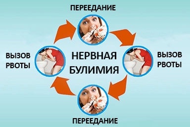 Лечение булимии в Марьяновке
